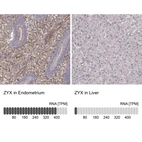Anti-ZYX Antibody