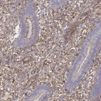 Immunohistochemical staining of human endometrium shows strong cytoplasmic positivity in stromal cells.