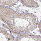 Immunohistochemical staining of human testis shows moderate cytoplasmic positivity in cells in seminiferous ducts.