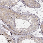 Immunohistochemical staining of human testis shows moderate cytoplasmic positivity in cells in seminiferous ducts.