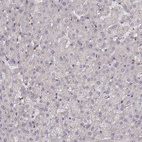 Immunohistochemical staining of human liver shows no cytoplasmic positivity in hepatocytes as expected.