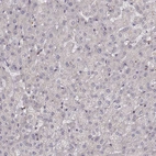 Immunohistochemical staining of human liver shows no cytoplasmic positivity in hepatocytes as expected.