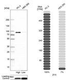 Western blot analysis in human cell lines PC-3 and HEK293 using Anti-ZYX antibody. Corresponding ZYX RNA-seq data are presented for the same cell lines. Loading control: Anti-PFN1.