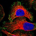 Immunofluorescent staining of human cell line U-2 OS shows localization to focal adhesion sites.