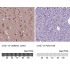 Anti-GAS7 Antibody