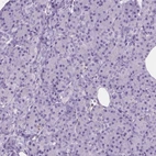 Immunohistochemical staining of human pancreas shows low expression as expected.