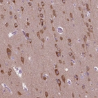 Immunohistochemical staining of human cerebral cortex shows high expression.