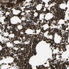 Anti-ANK1 Antibody