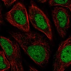 Immunofluorescent staining of human cell line SiHa shows localization to nucleoplasm.
