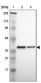 Lane 1: Marker [kDa] 229, 112, 84, 48, 32, 27, 17_br/_Lane 2: Human cell line RT-4_br/_Lane 3: Human cell line U-251MG sp