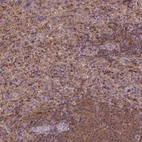 Anti-MATK Antibody
