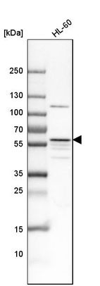 Anti-MATK Antibody