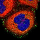Immunofluorescent staining of human cell line A-431 shows localization to cytosol & focal adhesion sites.