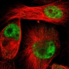 Immunofluorescent staining of human cell line U-251 MG shows localization to nucleoplasm.