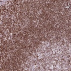 Anti-RASL11A Antibody