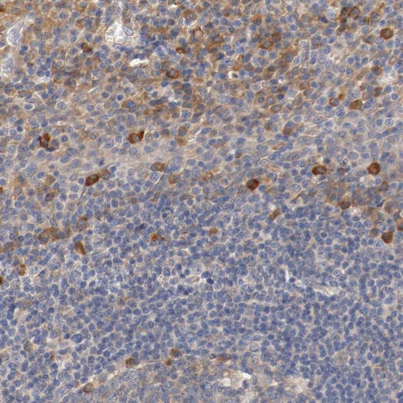 Anti-TNFSF13 Antibody