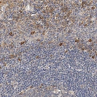 Anti-TNFSF13 Antibody