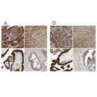 Anti-GALT Antibody