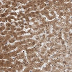 Immunohistochemical staining of human liver shows strong cytoplasmic positivity in hepatocytes.