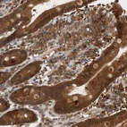 Immunohistochemical staining of human gastrointestinal shows strong cytoplasmic positivity in glandular cells.