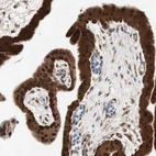Immunohistochemical staining of human placenta shows moderate cytoplasmic positivity in trophoblastic cells.