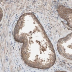 Immunohistochemical staining of human prostate shows moderate cytoplasmic positivity in glandular cells.