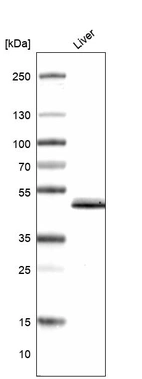 Western blot analysis in human liver tissue.