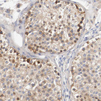 Anti-HGS Antibody