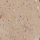 Immunohistochemical staining of human cerebral cortex shows moderate positivity in neuropil.