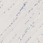Immunohistochemical staining of human skeletal muscle shows no positivity in myocytes as expected.