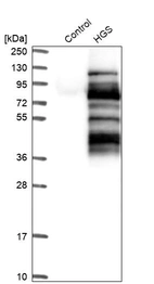 Western blot analysis in control (vector only transfected HEK293T lysate) and HGS over-expression lysate (Co-expressed with a C-terminal myc-DDK tag (~3.1 kDa) in mammalian HEK293T cells, LY401488).