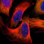 Immunofluorescent staining of human cell line U-2 OS shows localization to cytosol & vesicles.