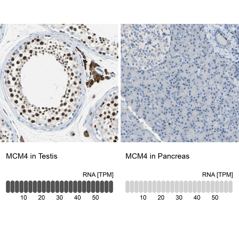 Anti-MCM4 Antibody