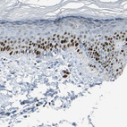 Anti-MCM4 Antibody