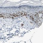 Immunohistochemical staining of human skin shows strong nuclear positivity in squamous epithelial cells.