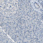 Immunohistochemical staining of human pancreas shows low positivity in glandular cells as expected.
