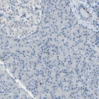 Immunohistochemical staining of human pancreas shows low positivity in glandular cells as expected.