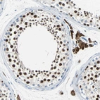Immunohistochemical staining of human testis shows strong nuclear positivity in cells in seminiferous ducts.