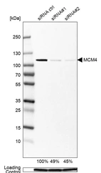 Western blot analysis in A-431 cells transfected with control siRNA, target specific siRNA probe #1 and #2, using Anti-MCM4 antibody. Remaining relative intensity is presented. Loading control: Anti-GAPDH.