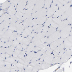 Immunohistochemical staining of human skeletal muscle shows no positivity in myocytes as expected.