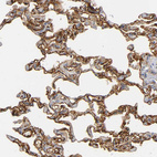 Immunohistochemical staining of human lung shows moderate membranous positivity in pneumocytes.