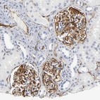 Immunohistochemical staining of human kidney shows moderate membranous positivity in cells in glomeruli.