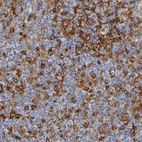 Immunohistochemical staining of human lymph node shows moderate membranous positivity.