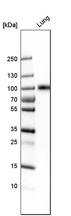 Western blot analysis in human lung tissue.