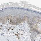 Immunohistochemical staining of human skin shows moderate cytoplasmic positivity in squamous epithelial cells.