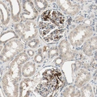 Immunohistochemical staining of human kidney shows strong membranous positivity in cells in glomeruli.