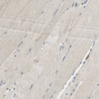 Immunohistochemical staining of human skeletal muscle shows very weak positivity in myocytes.