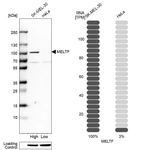 Western blot analysis in human cell lines SK-MEL-30 and HeLa using Anti-MELTF antibody. Corresponding MELTF RNA-seq data are presented for the same cell lines. Loading control: Anti-HDAC1.