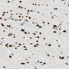 Anti-MYEF2 Antibody