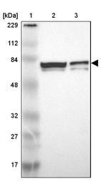 Lane 1: Marker [kDa] 229, 112, 84, 48, 32, 27, 17_br/_Lane 2: Human cell line RT-4_br/_Lane 3: Human cell line U-251MG sp